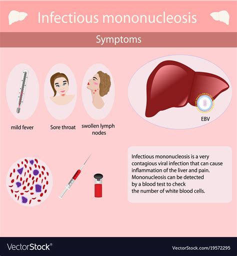 mononucleosis and dating